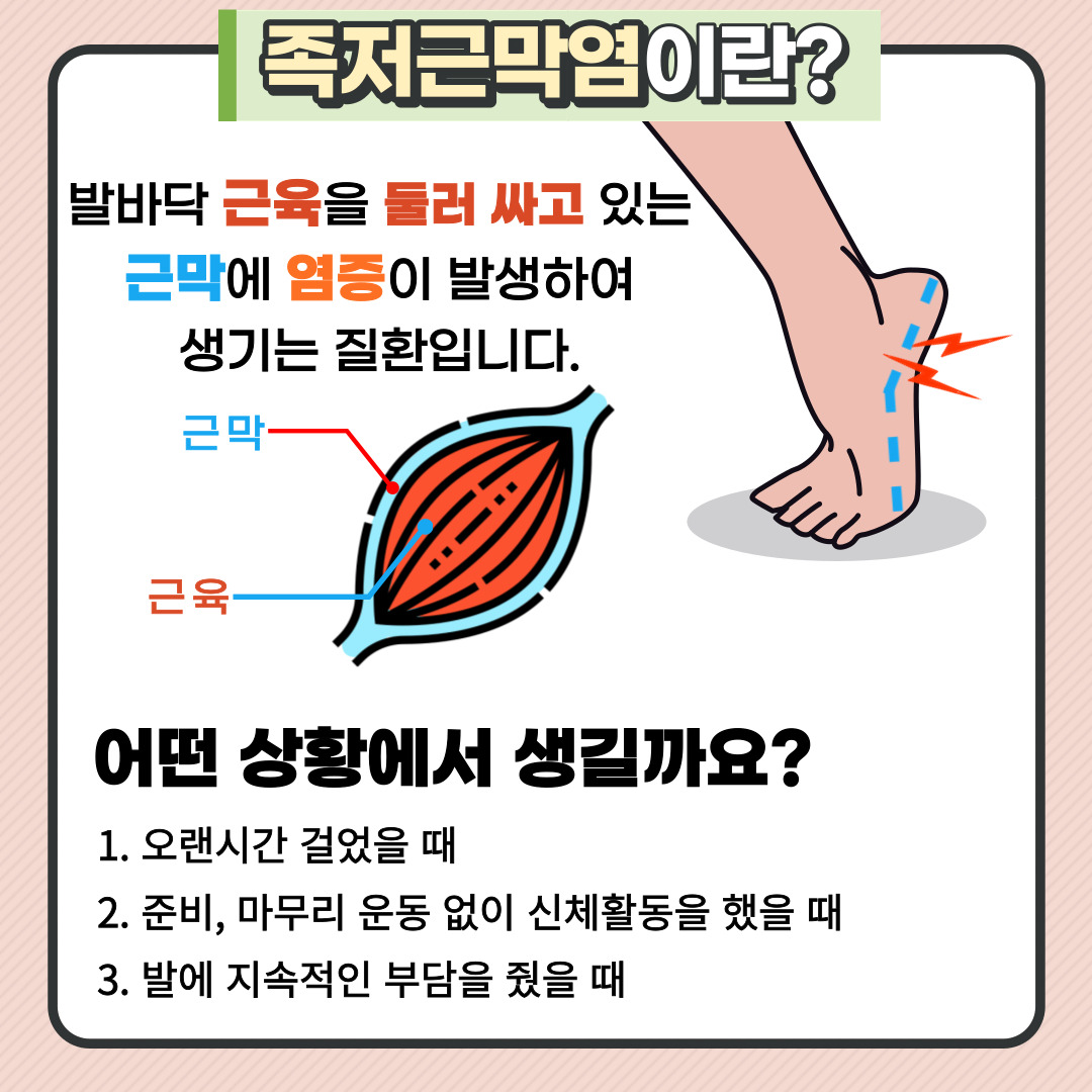 족저근막염이란 발바닥 근육을 둘러싸고 있는 근막에 염증이 발생해 생기는 질환입니다. 보통 오랜시간 걷거나, 준비운동과 마무리운동 없이 신체활동을 했을 때, 발에 지속적인 부담을 줬을 때 쉽게 발생합니다.